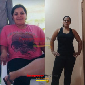 Antes e depois de aluna do Método Emagrecer na Certa